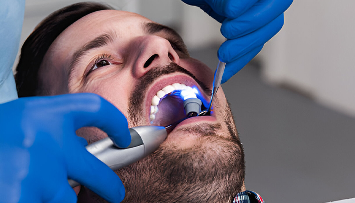 Scaling and Polishing