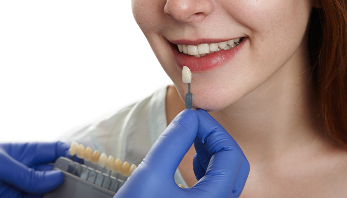 Zirconia Crown and Bridge